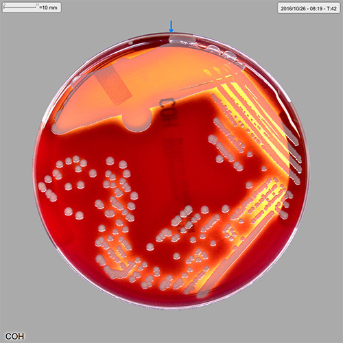 High Risk Samples - Black Country Pathology Services